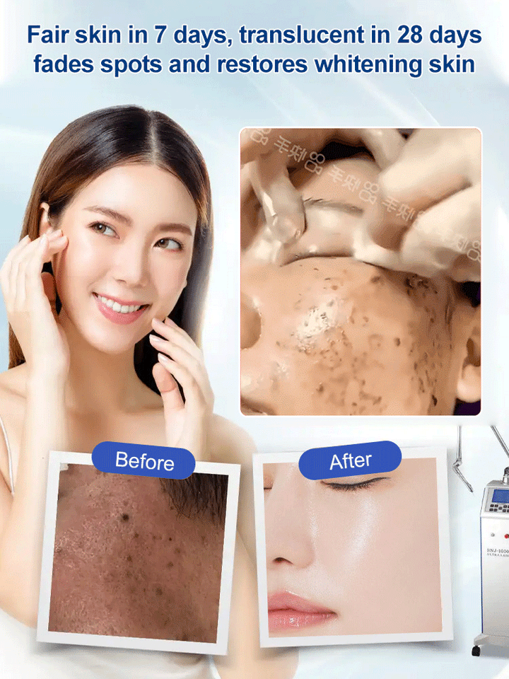 Last Day Of Discount š„ Dr. Hancy - White Spot Cream