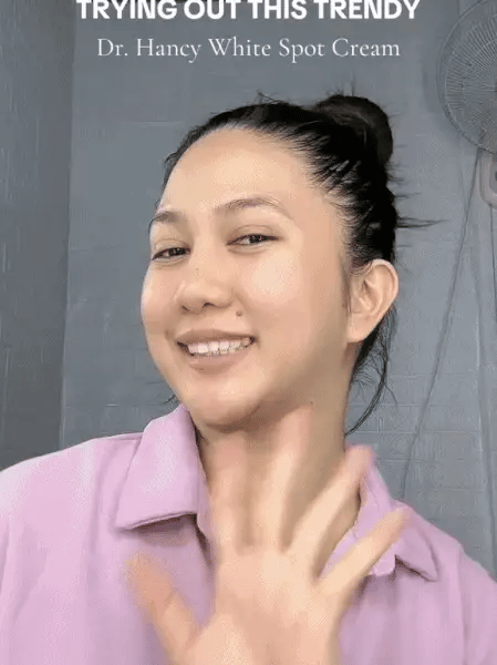 Last Day Of Discount š„ Dr. Hancy - White Spot Cream