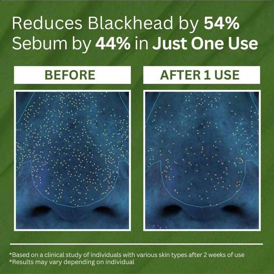 Last Day Of Discount 🔥Holy Basil Bubble Deep Mask